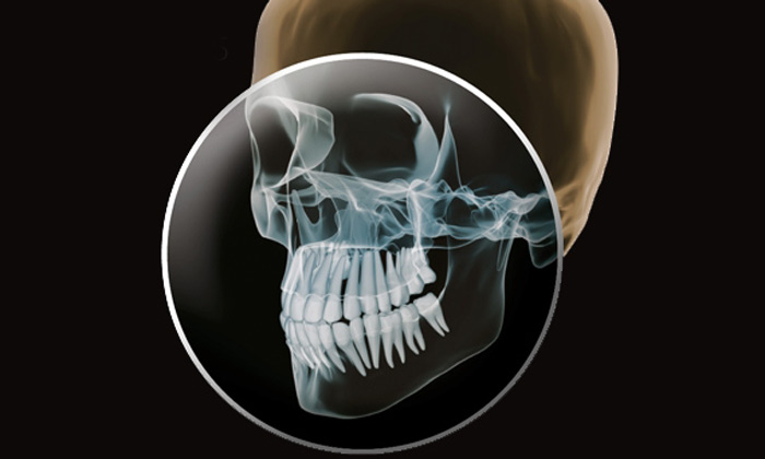 3D Röntgendiagnostik