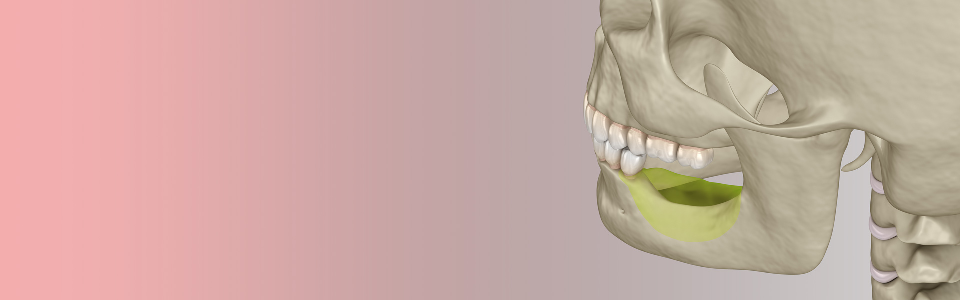 Verstärkung oder Knochenbindung vor zahnärztlichen Implantaten
