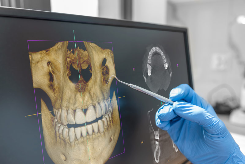 Anwendung der 3D-Röntgenerkennung