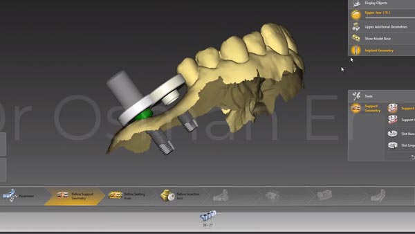 3D Implantatplanung Galileos