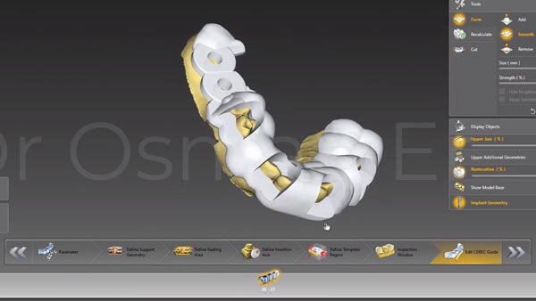 3D Implantatplanung Galileos