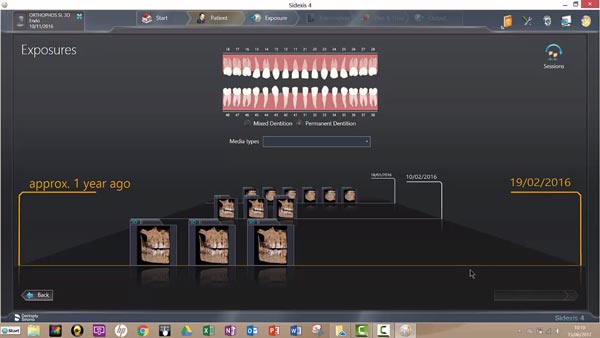 3D Implantatplanung Galileos